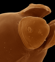 Worm Tales Part 2: Nematodes