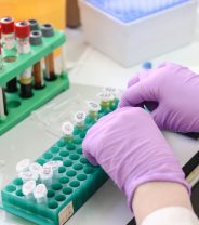 Why does my vet always want to do expensive tests?