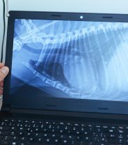 What's the difference between an X-ray and a scan - which is better?