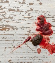 Why Does My Dog Have Bloody Poo? 