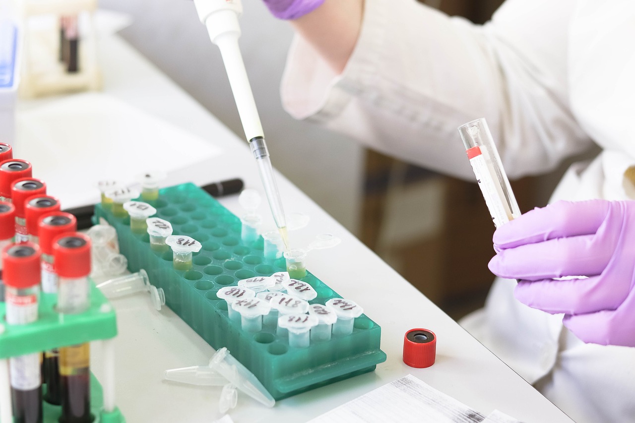 Serum tubes being loaded with pipette in laboratory