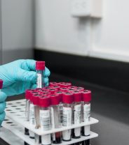 Is the new faecal worm test for dogs useful?