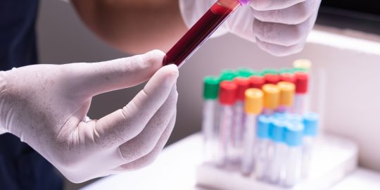 EDTA blood sample for testing in lab