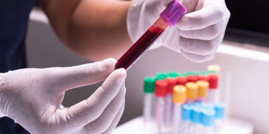 EDTA blood sample for testing in lab