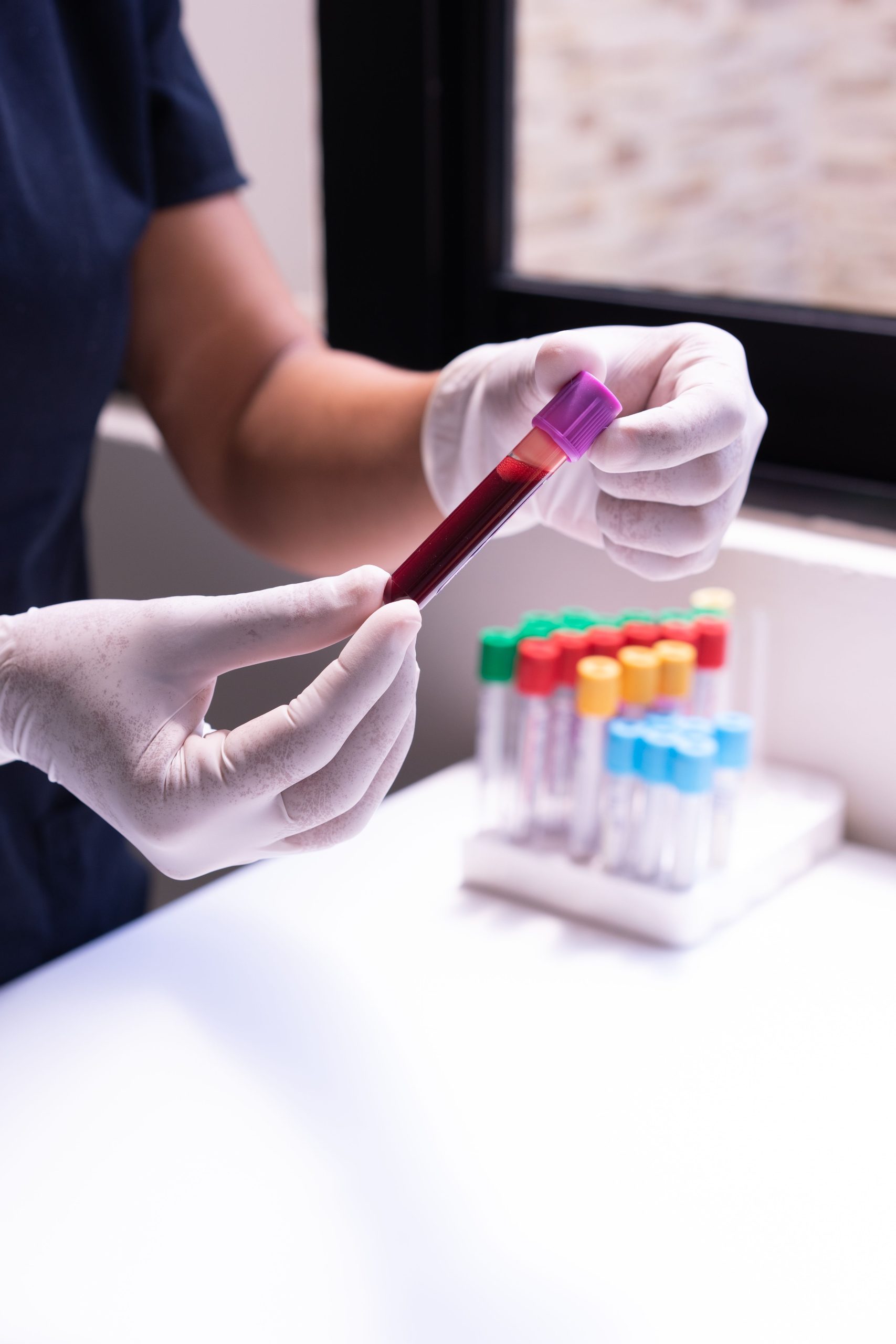 EDTA blood sample for testing in lab