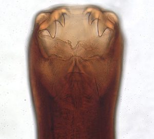 Ancylostoma caninum showing teeth -vDPDx - a Web site developed and maintained by CDC (Centers for Disease Control and Prevention)