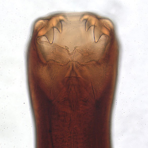 Ancylostoma caninum showing teeth -vDPDx - a Web site developed and maintained by CDC (Centers for Disease Control and Prevention)